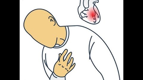 ACS (Acute Coronary Syndrome) Update_Dr Pradeep Rangappa