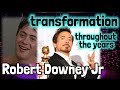 Robert Downey Jr teeth then and now: before and after surgery tooth transformation Iron Man veneers