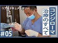 【コンジローマ治療】リアルな手術をお見せします！第4回