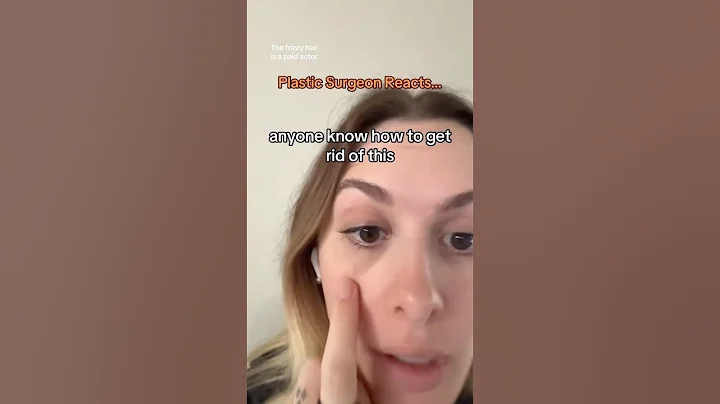 How To Get Rid Of Dark Circles Under Your Eyes! 👀✨