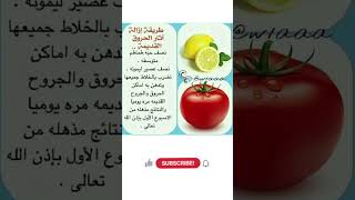 طريقة إزالة اثار الحروق القديمة فوائد_الطماطم_والليمون إزالة_أثار_الحروق علاجات_طبيعية