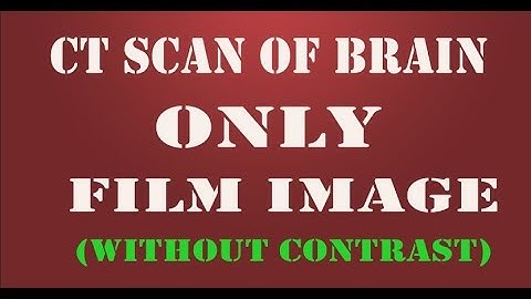ct scan of brain without contrast   film images