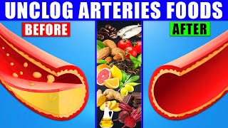 15 best foods that unclog arteries and prevent heart attack naturally
