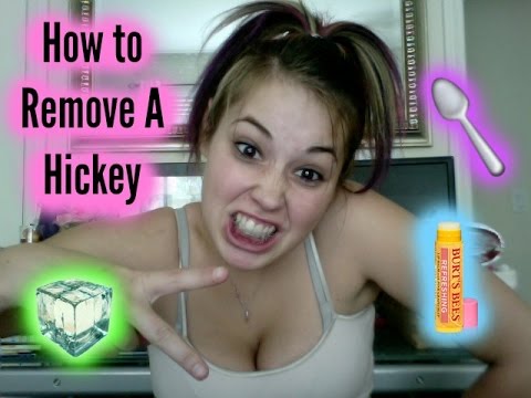 How to remove a hicky
