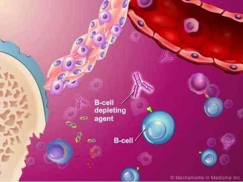 Video: Membandingkan Rheumatoid Arthritis: Enbrel Vs Humira