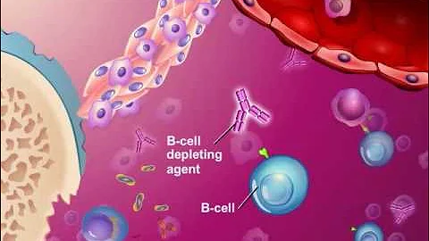 Novel Treatments for Rheumatoid Arthritis