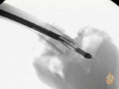 عن كثب - الحواسيب الطبغرافية ، محاولات لإنتاج قلب للأطفال