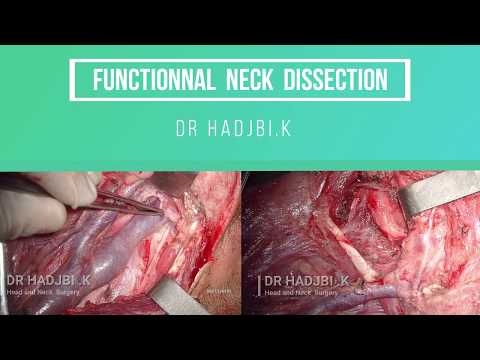 Vidéo: Efficacité De La Capécitabine Et De L'oxaliplatine Par Rapport à S-1 En Tant Que Chimiothérapie Adjuvante Dans Le Cancer Gastrique Après Dissection Des Ganglions Lymphatiques