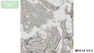 MACSYS project β Automatic Image Analysis