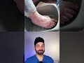 BIGGEST Blister I’ve Seen | Doctorly #shorts