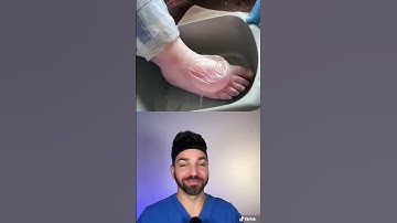 Thumbnail of BIGGEST Blister I’ve Seen | Doctorly #shorts