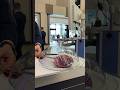 Настоящее сердце А вы видели медицина врач Shorts 
