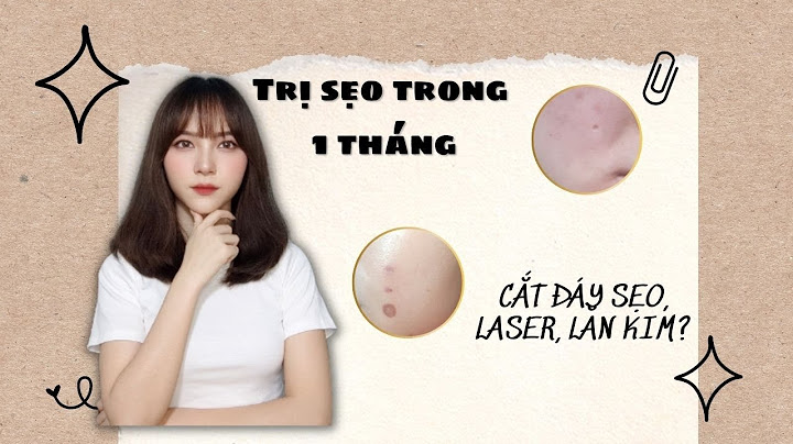 Review thuốc trị sẹo thủy đậu