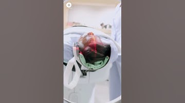 How Does a CT or CAT Scan work | Computed Tomography CT Scan of the Abdomen | Health Guideline