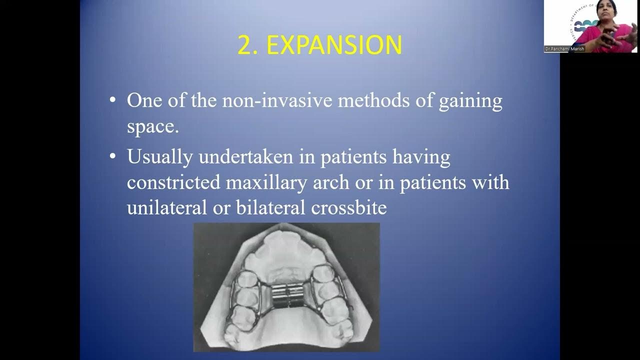METHODS OF GAINING SPACE Dr PANCHAMI DEPARTMENT OF ORTHODONTICS
