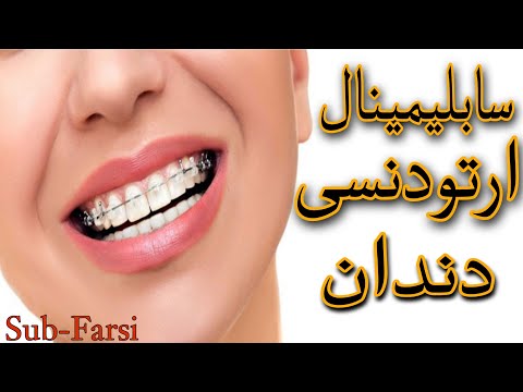سابلیمینال ارتودنسی دندان