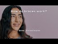 How do braces work?