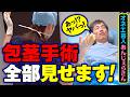 【実録】オネエ芸人「あんじぇらさん」の【包茎手術】全部見せます|MSクリニック