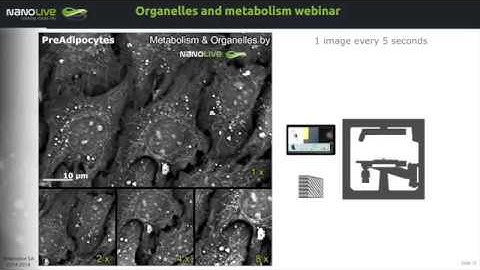 Webinar | Mitochondria and lipid droplets in the spotlight: Label free imaging of cell metabolism