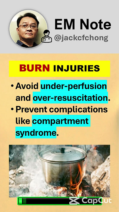 Burn Management