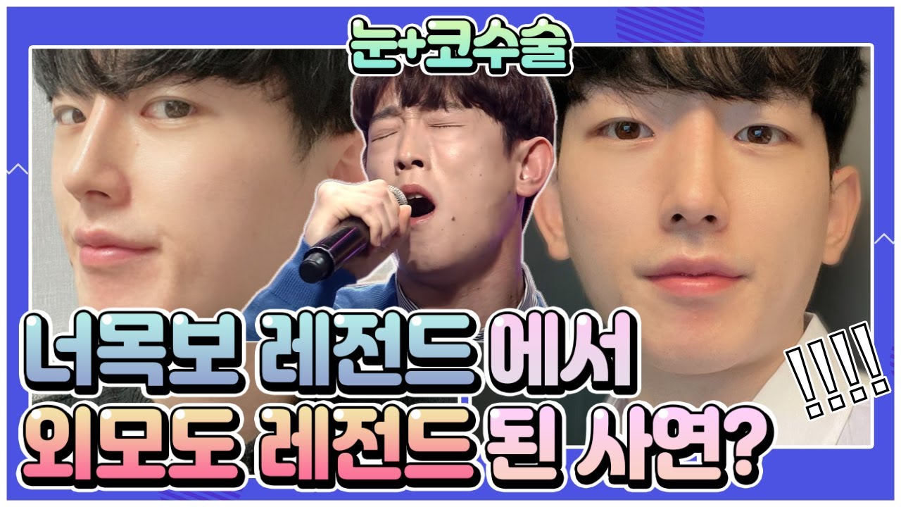 눈, 코성형│너목보 레전드가 이제 외모 레전드까지 됐다?! 남자성형 2주 ~ 4개월후👀