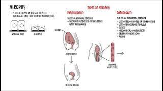 Cellular Adaptation - hyperplasia, hypertrophy, atrophy and metaplasia   cell injury