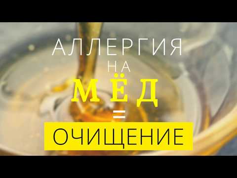 Аллергия на мёд - это симптом очищения организма