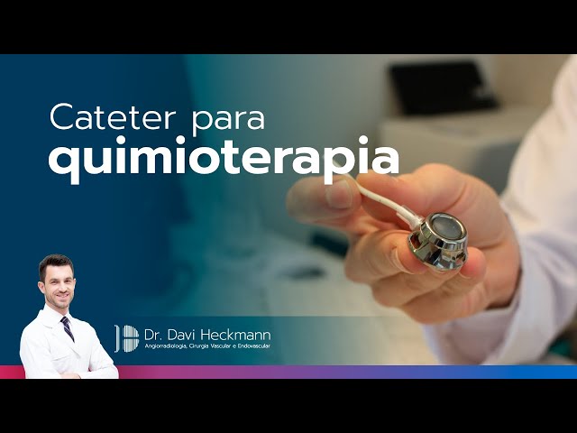 Implante de cateter para quimioterapia | Dr. Davi Heckmann