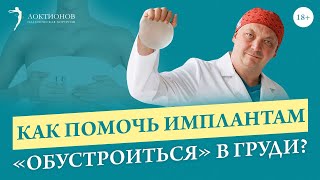 Как стимулировать опущение импланта после операции? Формируем ИДЕАЛЬНУЮ грудь / 18+