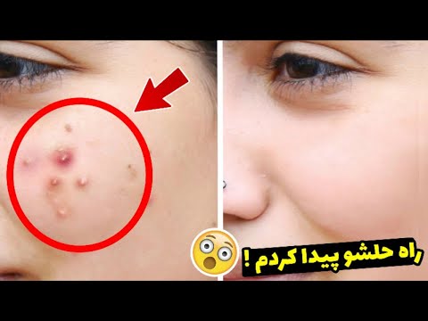 تصویری: نحوه بازی مار و نردبان: 11 مرحله (همراه با تصاویر)