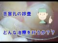 上顎2番舌盲孔カリエス【診査動画】