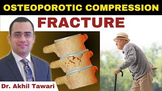Back Pain In Old Age | Osteoporotic Compression Fracture | Dr Akhil Tawari