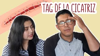 Nuestra CICATRIZ MÁS DOLOROSA - TAG DE LA CICATRIZ | Cristian &amp; Andry