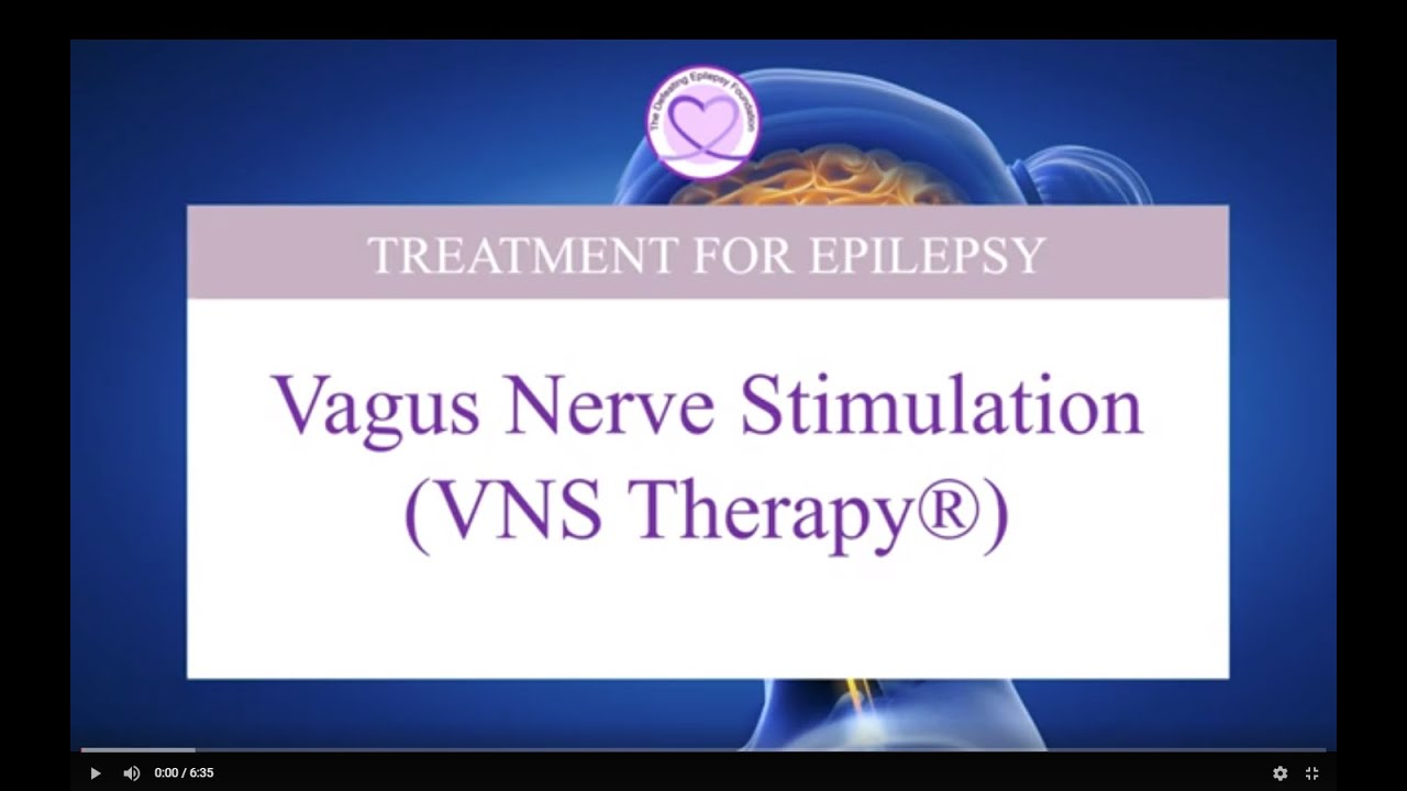 Vagus nerve stimulation - Mayo Clinic