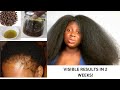 🔥😱This Will Grow Your Hair 100x Faster Than Fenugreek! Use 2x A Week For Extreme Growth ft ANALUISA