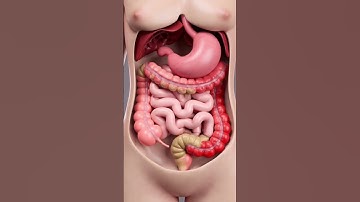 3D Animation of Constipation Explained | Gut Health l sss