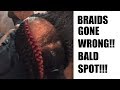 NATURAL HAIR HORROR STORY! GETTING BRAIDS GONE WRONG! I'M BALD!