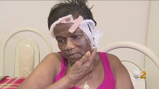Brooklyn Woman Sucker Punched By Stranger