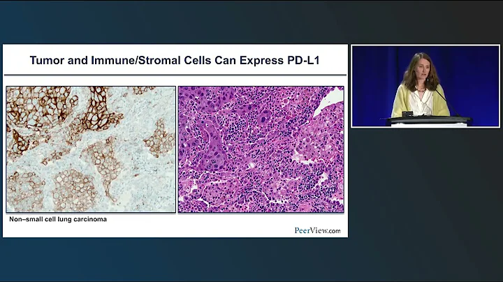 Gaining Confidence in Predicting and Assessing Response to Cancer Immunotherapies - DayDayNews