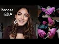 BRACES Q&A (cost, pain, experience, extractions + everything else you need to know)