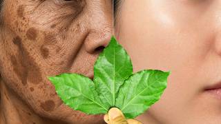 This plant heals everything! Millions of times stronger than BOTOX! with natural collagen