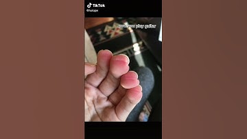 Thumbnail of pain of playing guitar for beginners