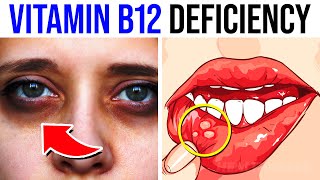 13 Warning Signs Of Vitamin B12 Deficiency You Must Not Ignore
