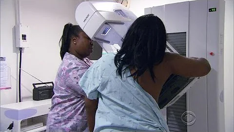 New guidelines on mammograms