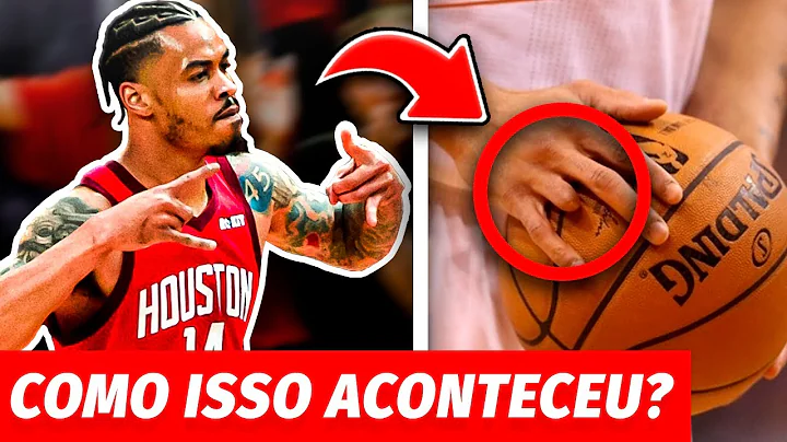 Ele Perdeu o DEDO e chegou a NBA, a Incrvel histri...