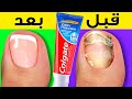 حيل رائعة لجمال طبيعبي || خدع للفتيات