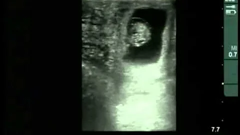 Cow #4539 Day 35 of Gestation