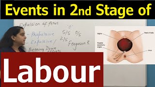 Second Stage of Labour | Events & Clinical Findings in 2nd Stage of Labour | Nursing Lecture