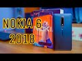 Nokia 6 2018 Full Review || Neglecting the TREND!!