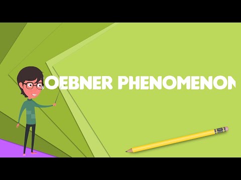 What is Koebner phenomenon?, Explain Koebner phenomenon, Define Koebner phenomenon